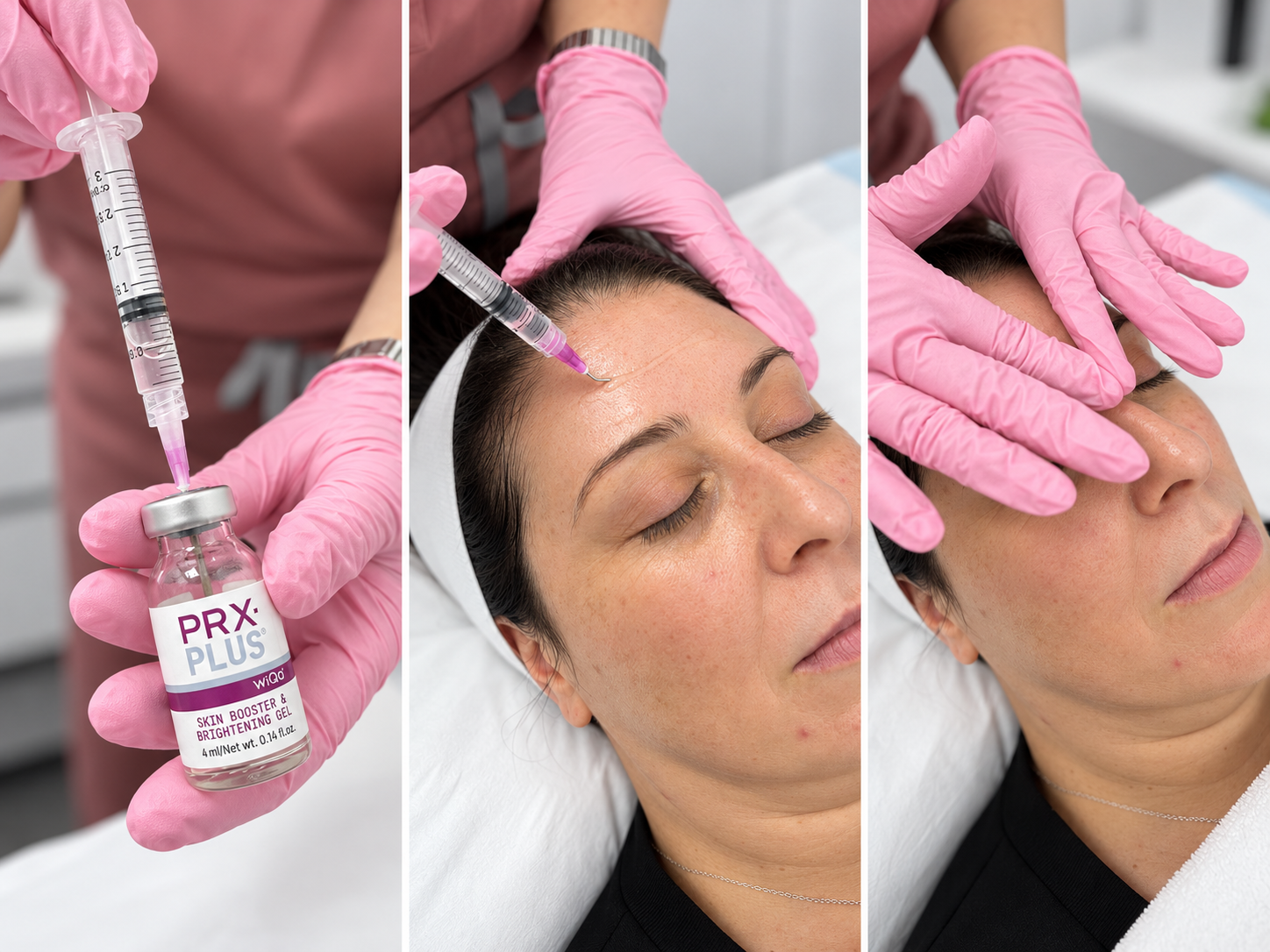 PRX-Plus Melbourne facial treatment at Collins Cosmetic Clinic